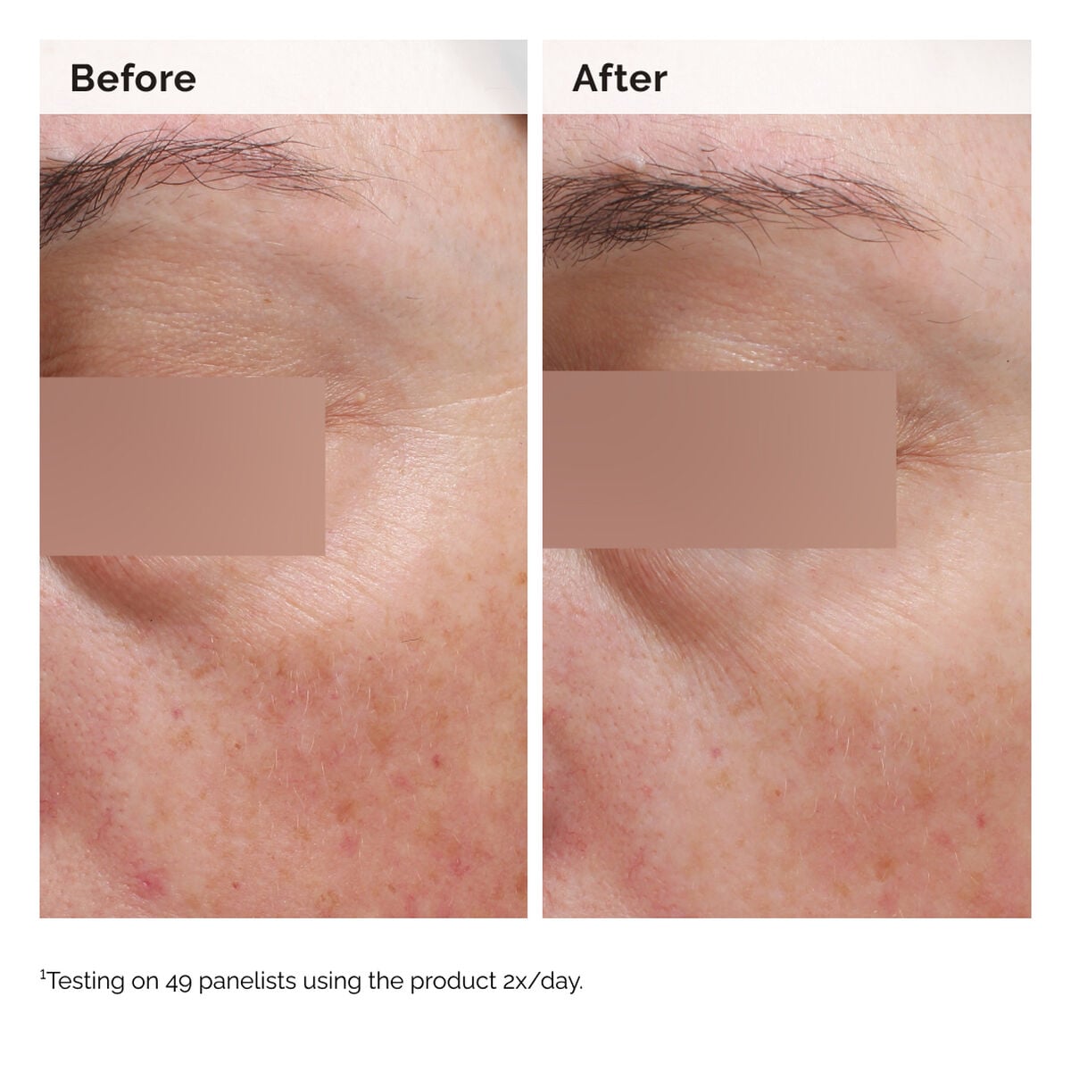 niacinamide-5-face-and-body-emulsion-r7 2024-08-23-ORD-Nia-5pct-Face-Body-B-A-Elasticity-Global-02-1x1.jpg