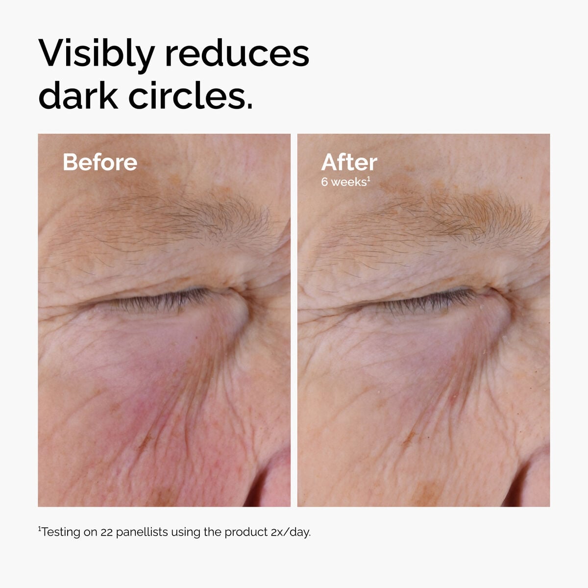 caffeine-solution-5-egcg-eye-serum-l1 ord-caffeine-solution-egcg-dark-circles-before-after.jpg
