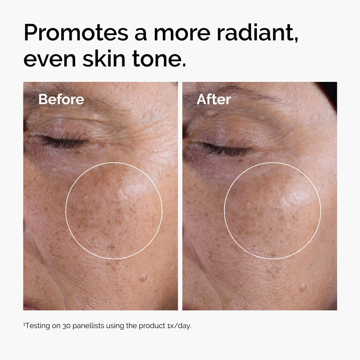 glycolic-acid-7-exfoliating-toner-b9 ord-glycolic-before-after-radiance.jpg