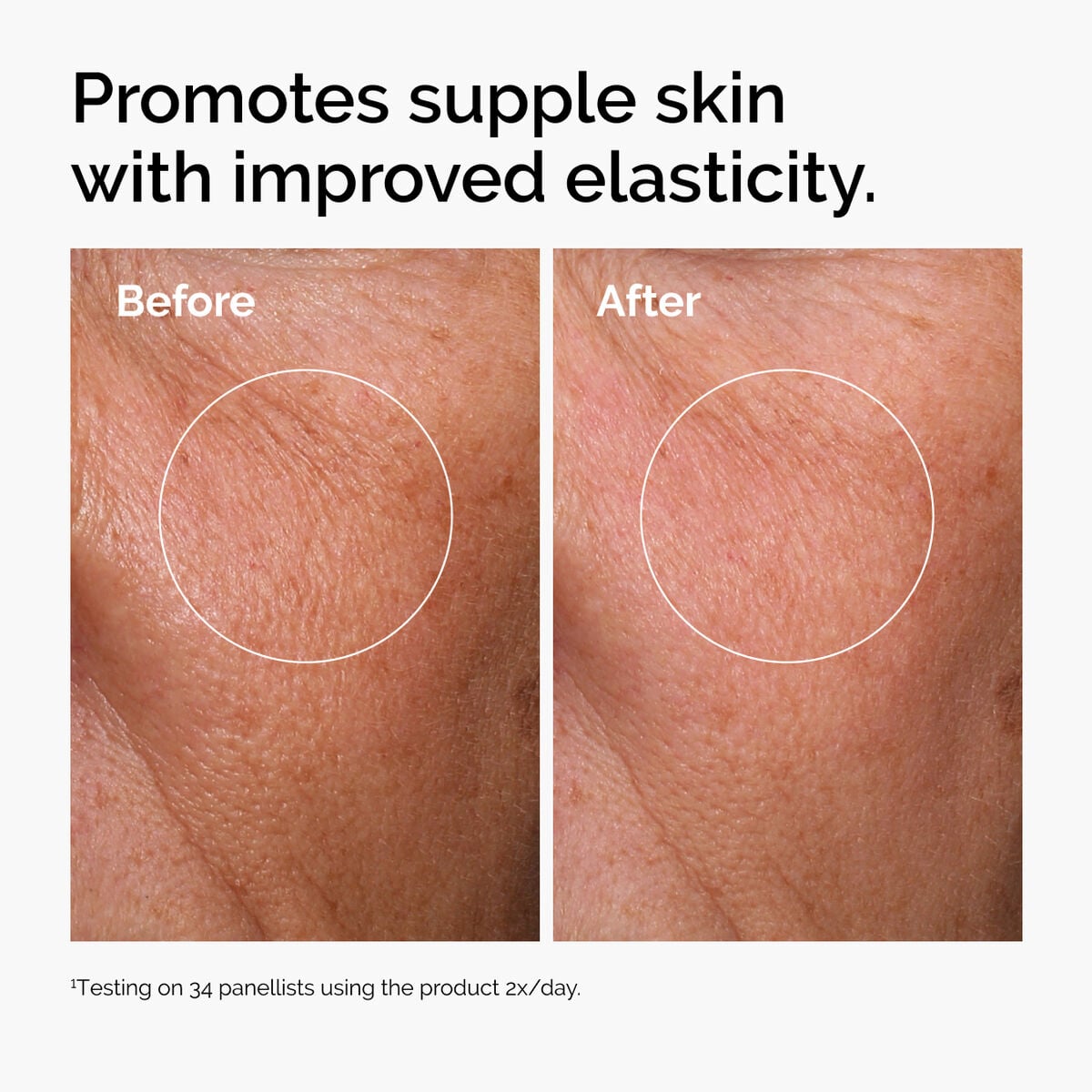 hyaluronic-acid-2-b5-with-ceramides-n9 ord-hyaluronic-acid-2pct-b5-hydrating-serum-before-after-elasticity.jpg