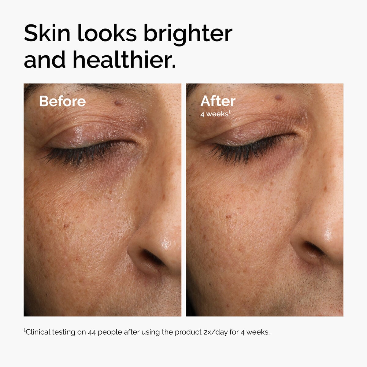 multi-antioxidant-radiance-serum-i2 ord-mars-before-after-healthy.jpg
