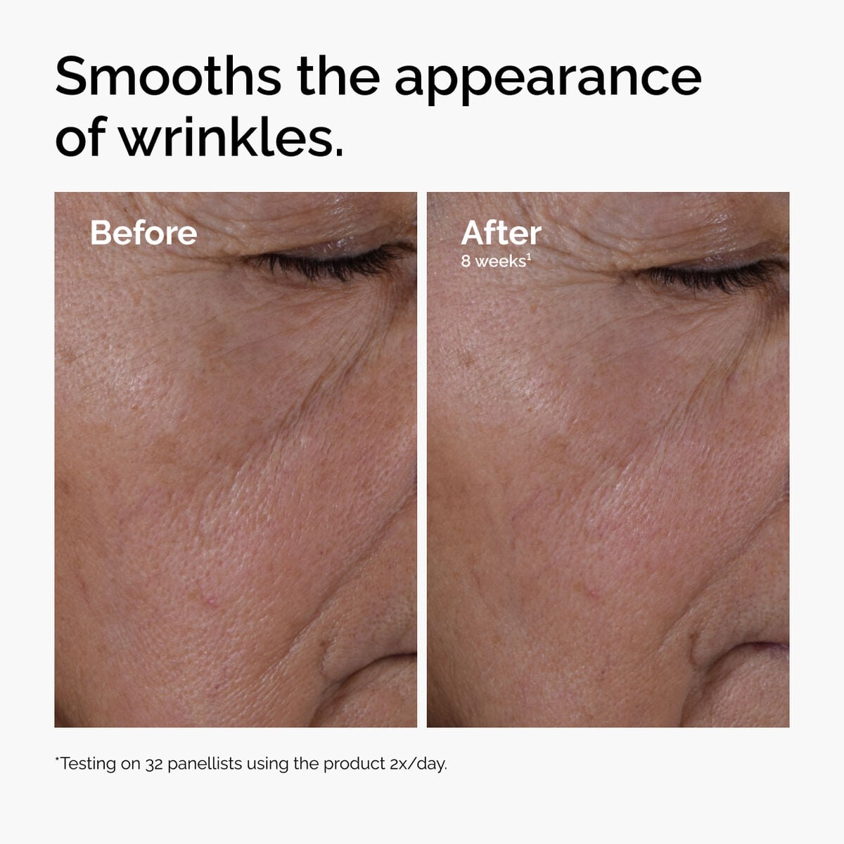 multi-peptide-ha-serum-k1 ord-multi-peptide-ha-serum-wrinkles-before-after.jpg