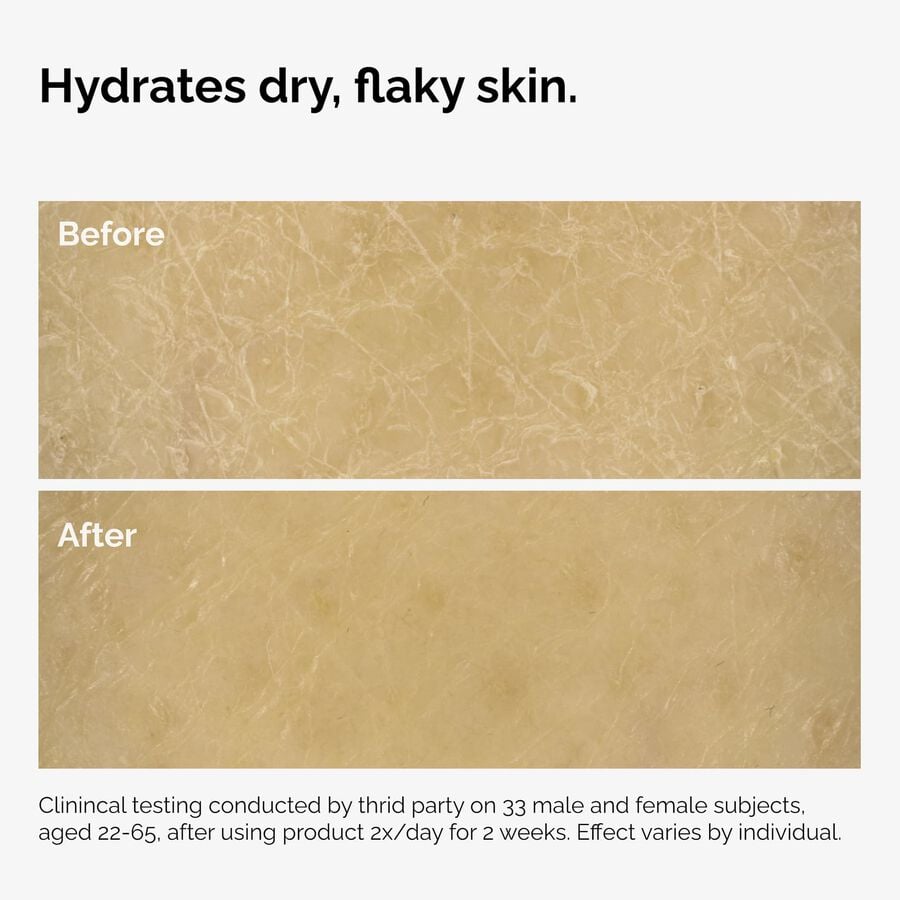 the-body-care-collection-q4 ord-natural-moisturizing-factors-inulin-body-before-after-graphic-02.jpg