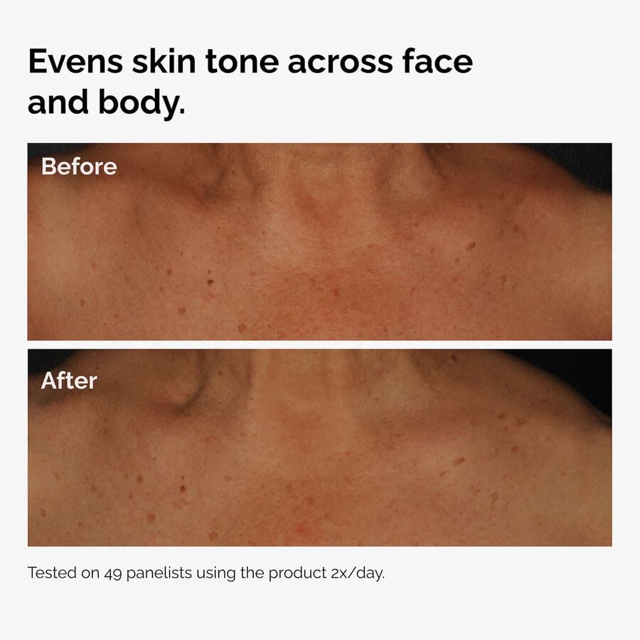 the-body-care-collection-q4 ord-niacinamide-face-body-serum-before-after-even-tone-graphic.jpg