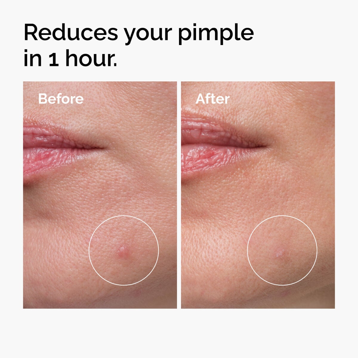 sulfur-10-powder-to-cream-concentrate-g1 ord-sulfur-10pct-powder-to-cream-concentrate-before-after-NA.jpg